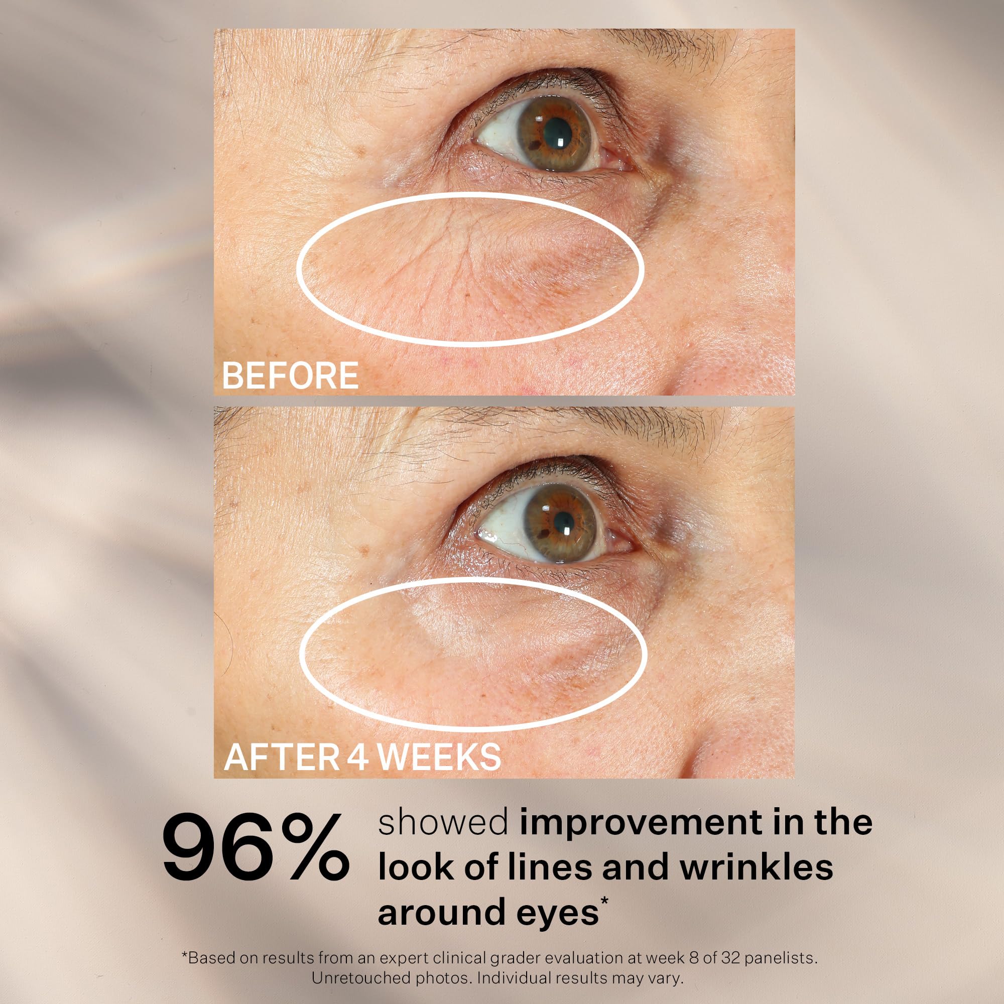 StriVectin Peptight Eye, Neck & Face Serums – Tighten, Lift & Brighten