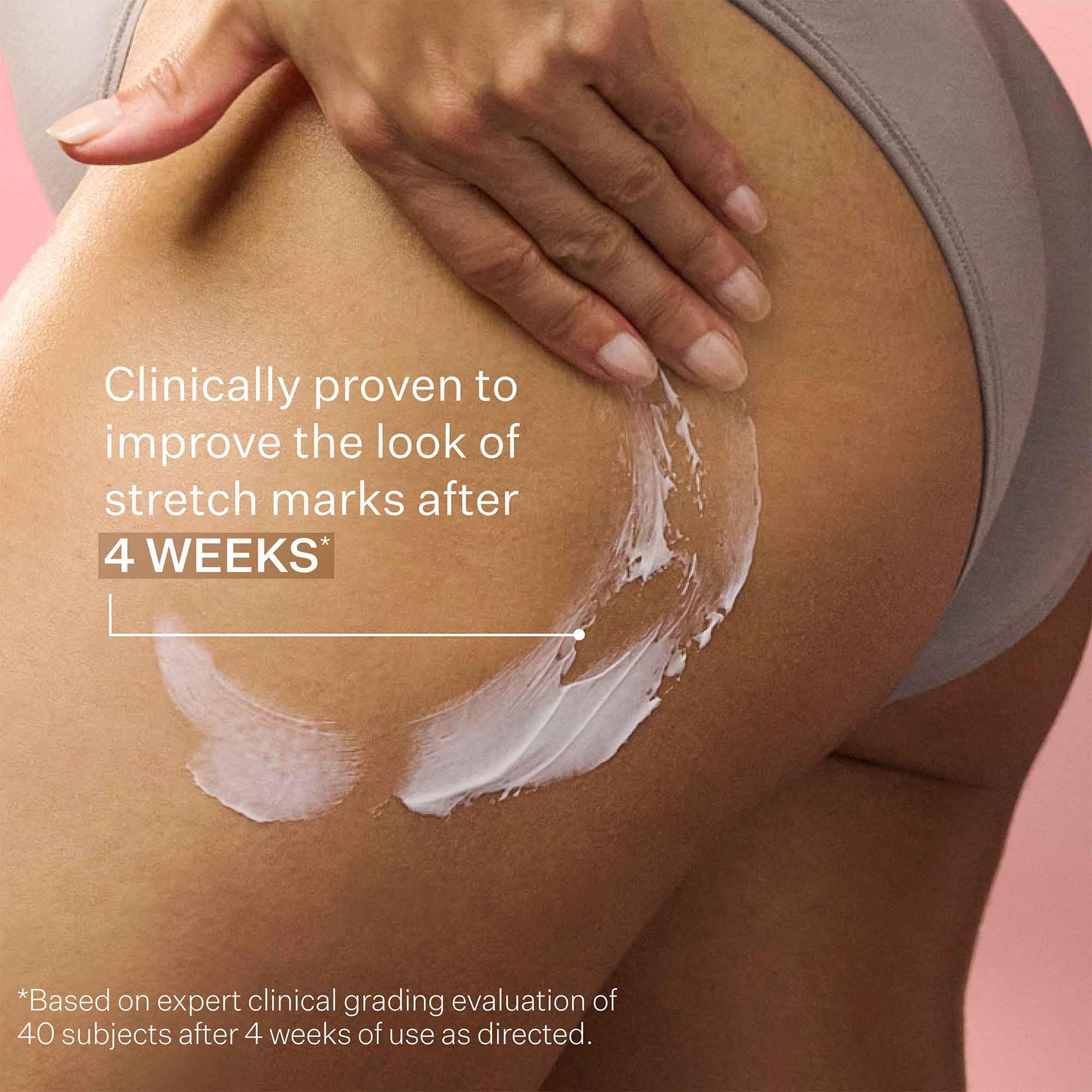 StriVectin SD Advanced Plus Intensive Moisturizer for Wrinkles & Stretch Marks with Peptides & Hyaluronic Acid