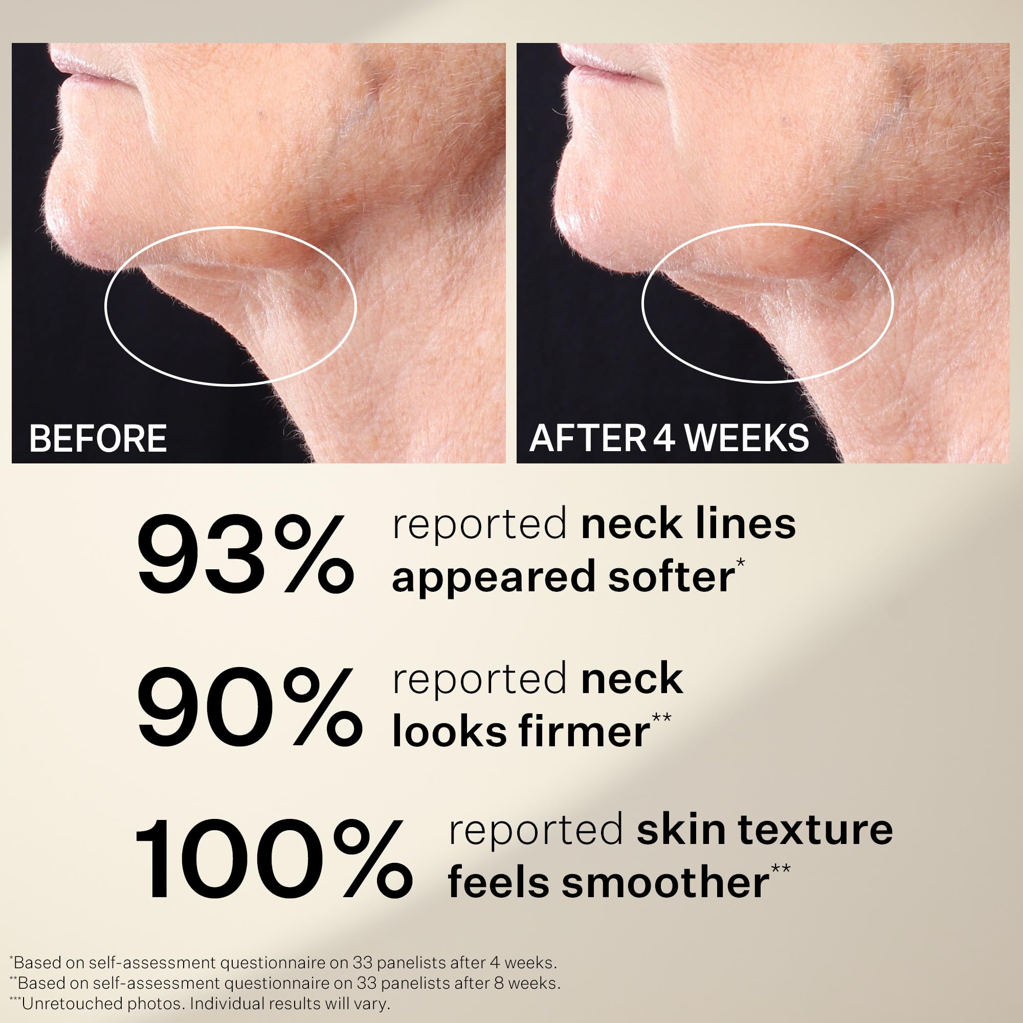 StriVectin Peptight Eye, Neck & Face Serums – Tighten, Lift & Brighten