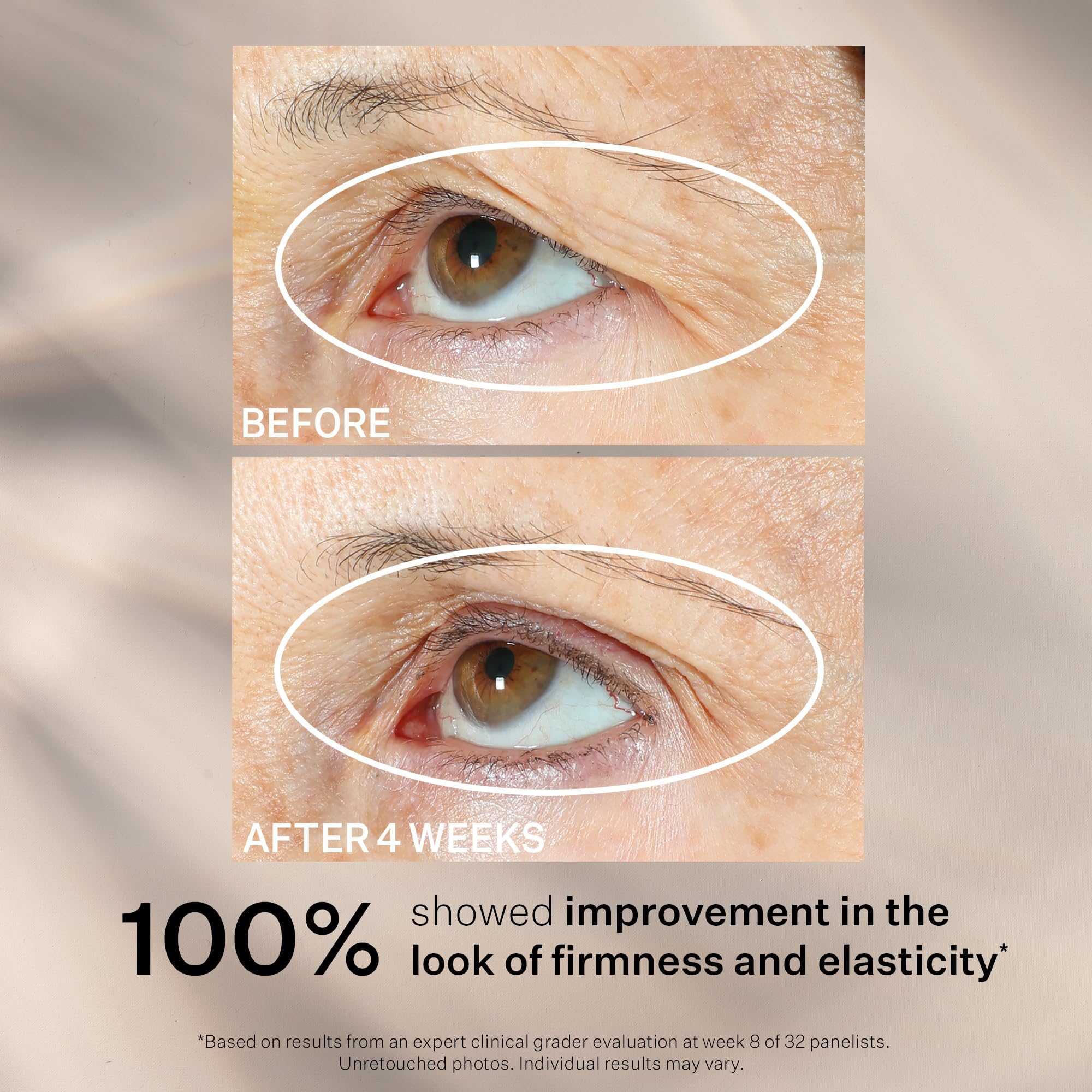 StriVectin Peptight Eye, Neck & Face Serums – Tighten, Lift & Brighten
