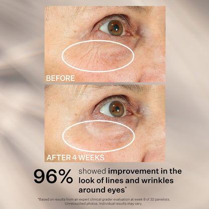StriVectin Peptight Eye, Neck & Face Serums – Tighten, Lift & Brighten