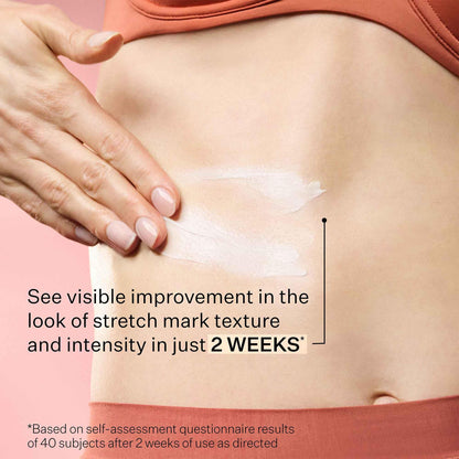 StriVectin SD Advanced Plus Intensive Moisturizer for Wrinkles & Stretch Marks with Peptides & Hyaluronic Acid