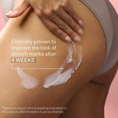 StriVectin SD Advanced Plus Intensive Moisturizer for Wrinkles & Stretch Marks with Peptides & Hyaluronic Acid