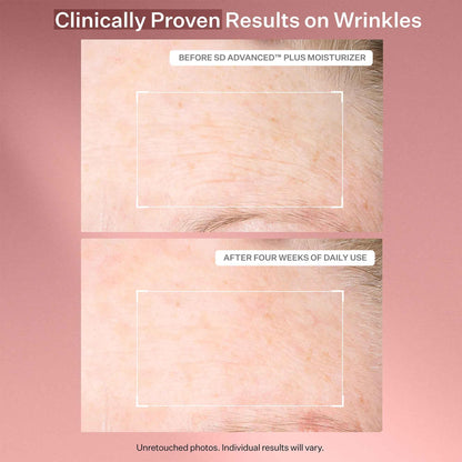 StriVectin SD Advanced Plus Intensive Moisturizer for Wrinkles & Stretch Marks with Peptides & Hyaluronic Acid