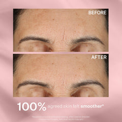 StriVectin Line BlurFector Instant Wrinkle-Blurring Primer for Smooth, Flawless Skin – 1 oz