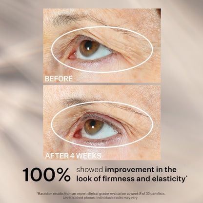 StriVectin Peptight Eye, Neck & Face Serums – Tighten, Lift & Brighten